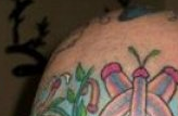 Tattoo Removal, Anyone?